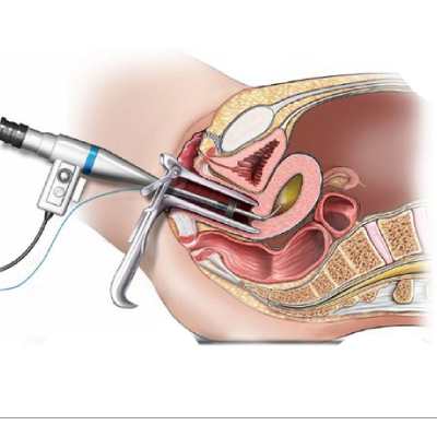 Endoscopy Medical Illustration